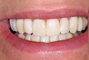Winchester Dental | ZOOM  Whitening, Snoring Appliances and Emergency Treatment