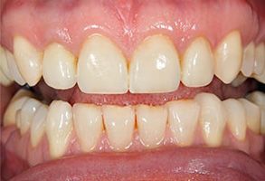 Winchester Dental | Cosmetic Dentistry, TMJ Disorders and Implant Dentistry