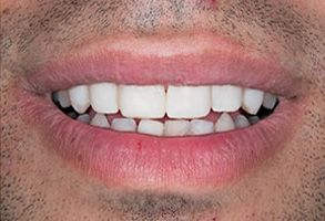 Winchester Dental | Periodontal Treatment, Sleep Apnea and Snoring Appliances