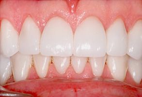 Winchester Dental | Dental Bridges, Oral Exams and Implant Dentistry