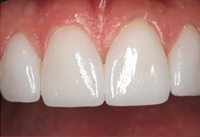 Winchester Dental | Botox reg , Oral Exams and Cosmetic Dentistry