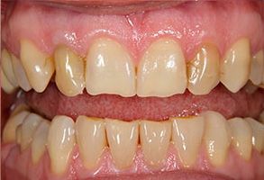 Winchester Dental | Implant Dentistry, Dentures and Invisalign reg