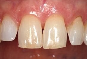 Winchester Dental | Oral Cancer Screening, Dental Cleanings and Dentures