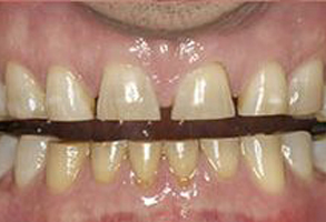 Winchester Dental | Ceramic Crowns, Invisalign reg  and Botox reg